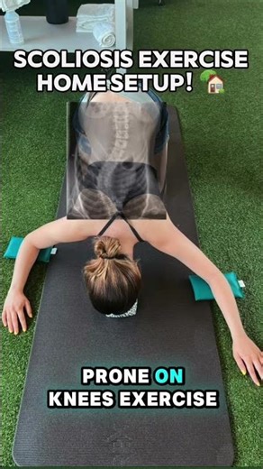 Schroth method home exercise setup for scoliosis! Message “STARTER” for details!