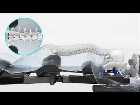 ProAxis® Spinal Surgery Table Animation