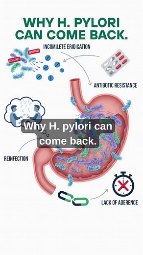 H. Pylori Recurrence: Why It Comes Back & How to Prevent It