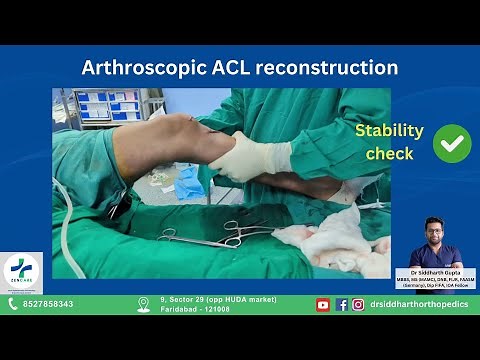 Arthroscopic ACL reconstruction (Key Hole surgery)