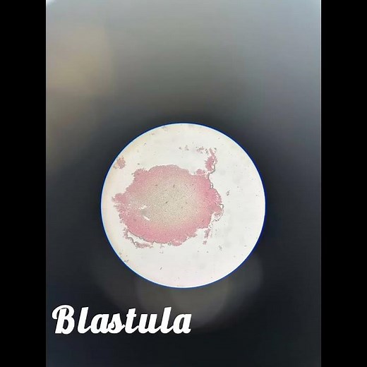 Plus two zoology practical embryology slide identification #zoology