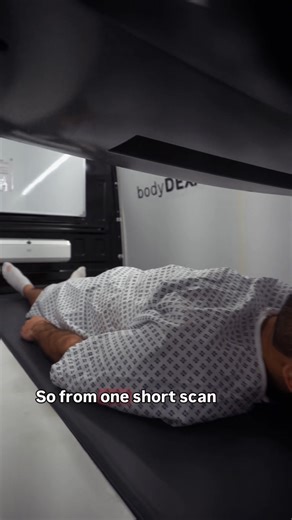 🚐 Crawley, Its Finally Here 🙏 Crawley is the first stop for the UK’s first fully mobile DEXA scans — and this video shows exactly what it’s like to have one. DEXA is the gold-standard way to truly understand your body: • Accurate body fat percentage • Visceral (hidden) fat around your organs • Muscle balance and asymmetry • Bone health insights Things no scale, watch or gym machine can show 📊 📍 You’ll find them at Smartt Gym, Crawley 🎟️ There’s an exclusive discount code hidden in the video