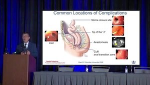 Evaluation and Management of Pouch Disorders