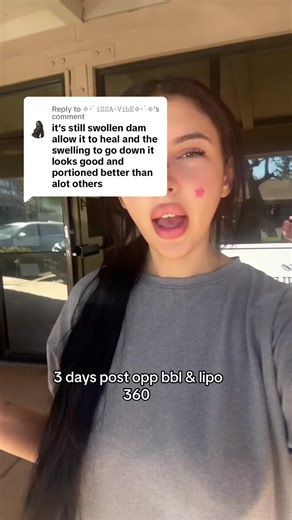 3 Days Post-Op BBL and Lipo 360 Update