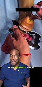 Plantar Fasciitis Scraping