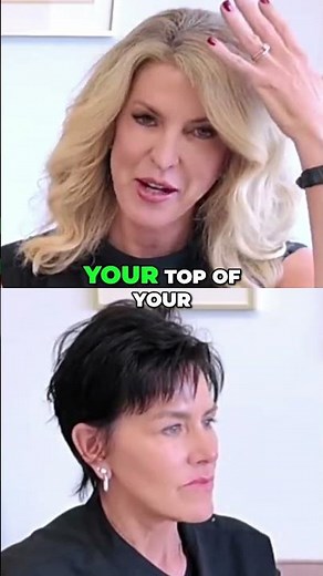 Brow Lift Recovery Explained | What Healing Really Feels Like After Surgery 💫