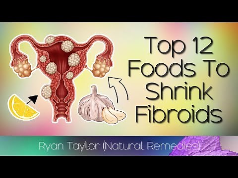 12 Foods That Shrink Fibroids (Naturally)