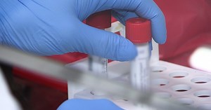 County Releases Home ZIP Codes Of COVID-19 Cases, But Does That Tell Us Anything?