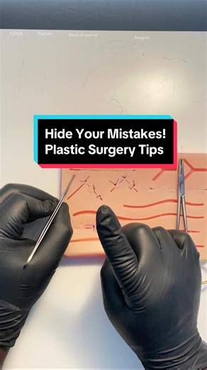 Gaps in Your Suture Line: Fixing Techniques for Surgeons