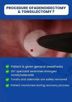 Adenoidectomy & Tonsillectomy by Dr Varun