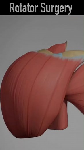 7.5K views · 17 reactions | 3D animation of Rotator Cuff Repair #doctor #documentaryphotography #DoctorWho # reel # shorts #DoctorWho | SMART Doctor | Facebook