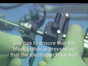 Instruments assembly and PUV fulgration procedure tutorial by Dr Ramesh Babu