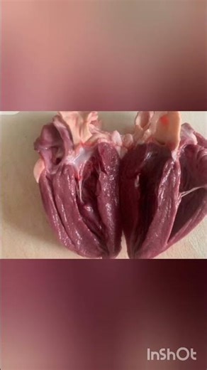 Internal part of human heart