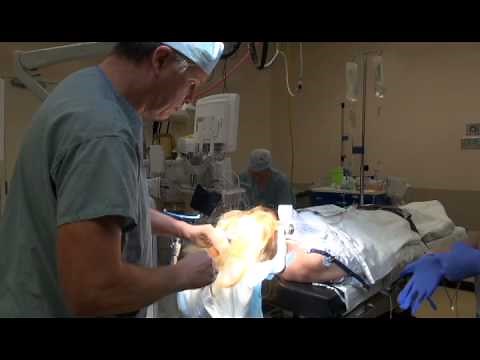 Brain Surgery with Dr. Mark Matishak - 04 Haircutting