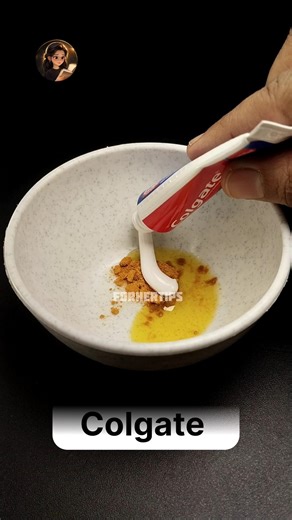 Teeth Whitening at Home 😱 2 Min Me Yellow Teeth Se Safed Teeth | Real Results