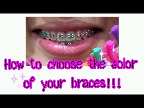 How to choose the color of your braces!!!