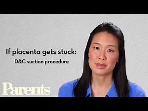Placenta | Labor & Delivery | Parents