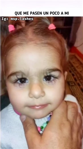 Pestañas largas: El lado oscuro de la tricomegalia