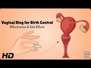 Vaginal Ring Explained: Benefits, Risks, and How It Works