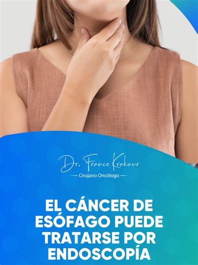 🔎 El cáncer de esófago no siempre requiere una cirugía grande. Cuando se detecta muy pequeño, en centros especializados puede tratarse por endoscopía, evitando quitar todo el esófago y mejorando enormemente la calidad de vida. 👨‍⚕️ Infórmate conmigo, Dr. Franco Krakaur | Cirujano Oncólogo. 📲 Instagram | Facebook | YouTube: @drfrancokrakaur 📲 WhatsApp: 55 3471 0500 COFEPRIS: 2517012002A00002 #CáncerDeEsófago #Endoscopía #DetecciónATiempo #Oncología #CirugíaOncológica #ResecciónEndoscópica #Cá