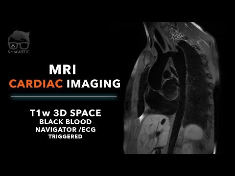MRI CARDIAC IMAGING – T1w 3D SPACE BLACK BLOOD