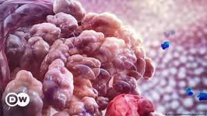 A blood test for cancer