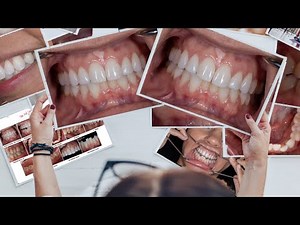 Dental Photography Basics - Standard Views and Photo Series Options for Your DENTAL Practice!