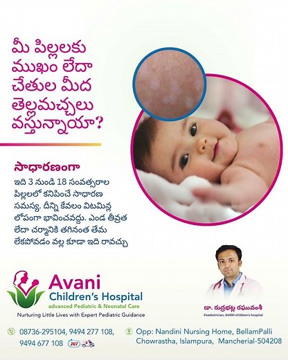 White Patches on Children's Skin | Causes, Treatment & When to See a Doctor