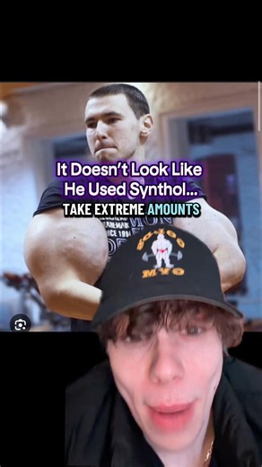 A Bit Of Synthol Wouldn’t Do This!