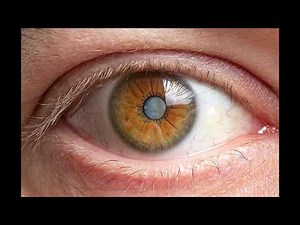 Toxocariasis: What You Need To Know