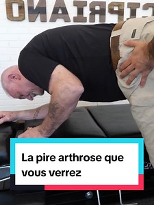 Une fois soudés, plus rien ne bouge. #arthrose #chiropracteur #prime