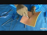 Laparoscopic Port Closure or Fascial Closure Needles • Video • MEDtube.net