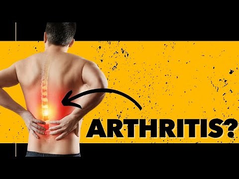 Top 3 Exercises For Arthritis in your Back: Back Pain