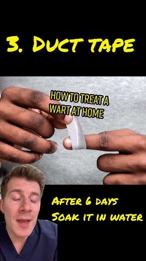 HOW TO TREAT A WART AT HOME #wart #veruca #verruca #warttreatment #fyp #foryoupage #meded #medicaleducation #health #healthcare #healthinfo #healthinformation #pharmacy #pharmacist