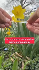 12K views · 170 reactions |  Follow @mltglobe Medical Lab Technology - MLT | Medical Lab Technology - MLT Globe | Facebook