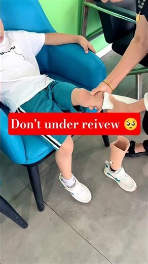 Amazing Prosthetic Leg Walking Skills | Real Life Prosthetic User