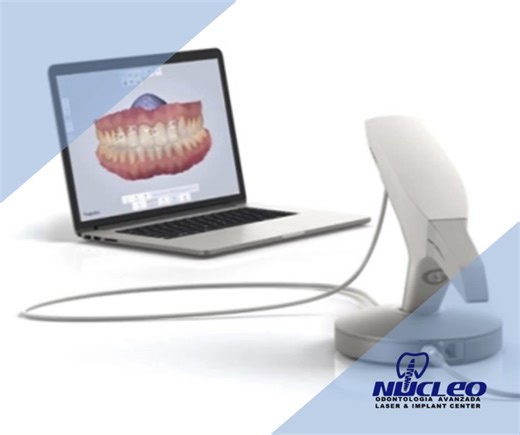  Precision in Every Scan! 醴 The 3Shape TRIOS® Intraoral Scanner delivers comfort, speed, and unmatched accuracy for your dental treatments — no more messy impressions! ✨ Experience cutting-edge care at Nucleo Dental.  +1 (915) 308-0101 |  nucleodental.com . #3ShapeTRIOS #DigitalDentistry #NucleoDental #CiudadJuarez #ElPasoTX #DentalTechnology #PerfectSmile #ModernDentistry #OralHealth | Nucleo Dental | Facebook