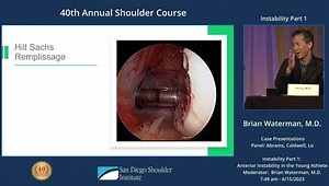 Case Presentations: Anterior Shoulder Instability and First Time Dislocations