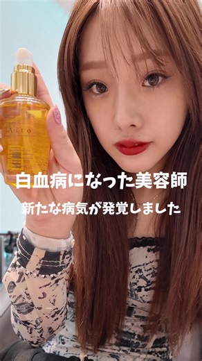 多嚢胞性卵巣症候群の基本知識と影響