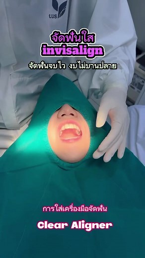 (ep. 2) คนไข้มารับการติด attachment ปุ่มเคลื่อนฟันและรับเครื่องมือ #จัดฟันแบบใส #Invisalign กับคุณหมอแอน🔥จัดฟัน แบบใส #invisalign เริ่ม 59,000 จัดฟันจบไว งบไม่บานปลาย รับ ฟรี! โปรโมชั่นแพ็กเก็จเพิ่ม ✅ สแกนฟัน Digital 3D ปรกติครั้งละ 5,000 บาท ✅ รีเทนเนอร์✅ เอกซ์เรย์✅ เคลียร์ช่องปากลด 10%LINE ID : @iDentistClinicLINE ADD FRIEND: http://line.me/ti/p/@identistclinic#จัดฟัน #ทำฟัน #identistclinic | IDentist คลินิกทันตกรรม: ทำฟัน จัดฟัน ทำรีเทนเนอร์ / จัดฟันใส Invisalign