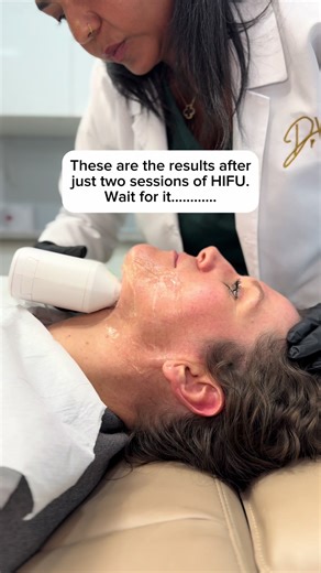 Achieve Stunning Results with HIFU Treatment