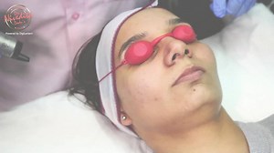 67 shares · 305 comments | Under-eye circles may be a result of...