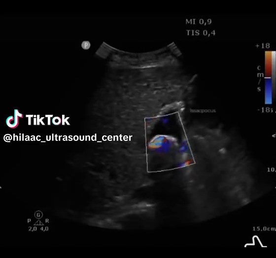 Hilaac Ultrasound Center على TikTok