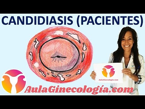 CANDIDIASIS VAGINAL (PACIENTES): Causas, síntomas, tratamiento - Ginecología y Obstetricia -