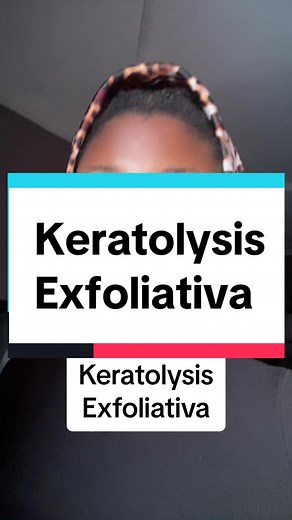 Understanding Keratolysis Exfoliativa: Treatment & Skincare Tips
