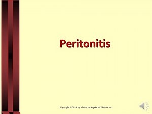Lecture on Peritonitis