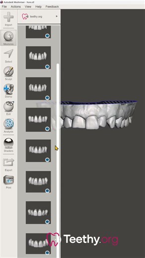 Download free Anterior teeth for Meshmixer #teethy #meshmixer #dentalcad #dentistry #smiledesign