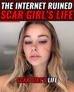 The Internet Ruined "Scar Girl's" Life.. | Fun For Dayz