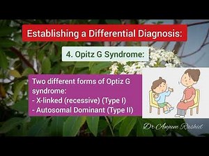 Orbital Hypertelorism Causes, Symptoms, Diagnosis, Measurement | Wide Set Eyes