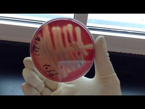 TSA Sheep's Blood Medium - Hemolysis
